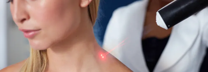 cold laser therapy treatment for pain management